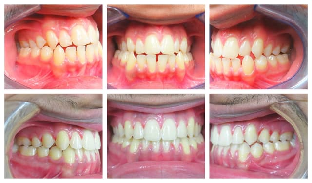 Blooming Braces photo