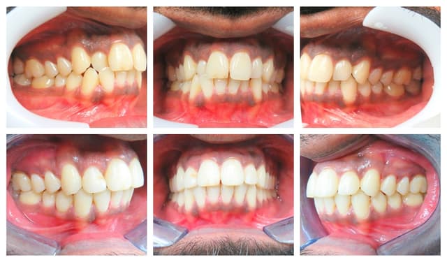 Blooming Braces photo