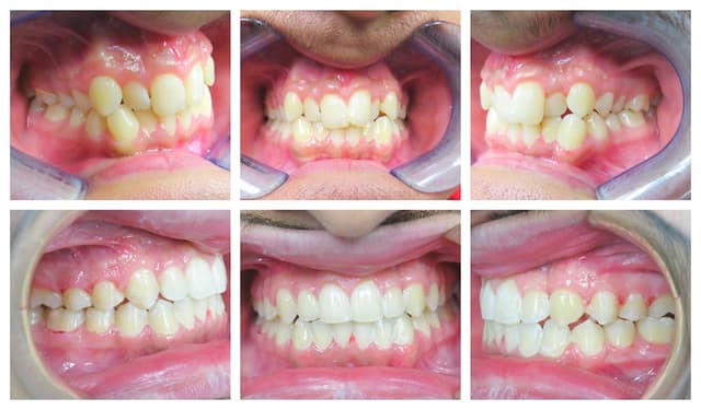 Blooming Braces photo