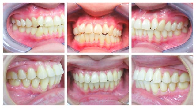 Blooming Braces photo
