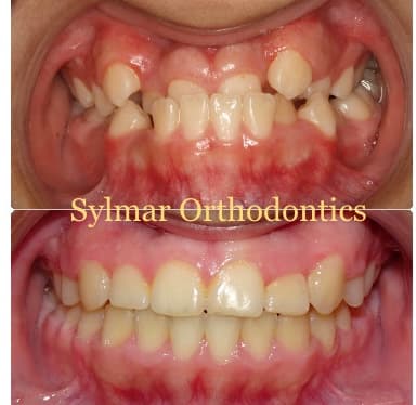 Sylmar Orthodontics photo