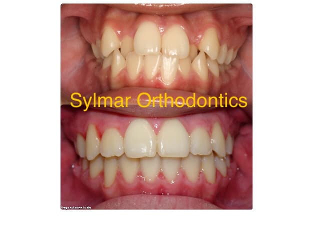Sylmar Orthodontics photo