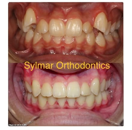 Sylmar Orthodontics photo