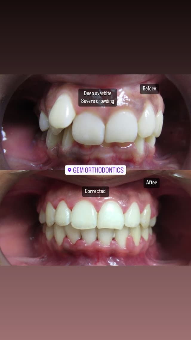Gem Orthodontics photo
