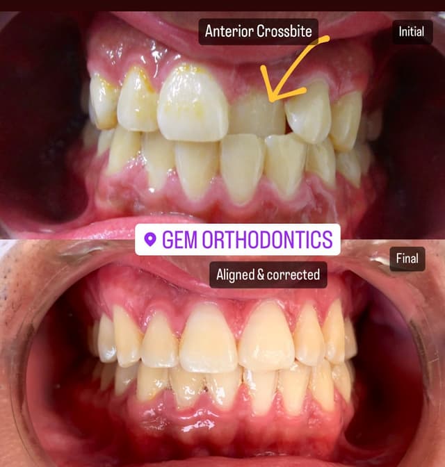 Gem Orthodontics photo