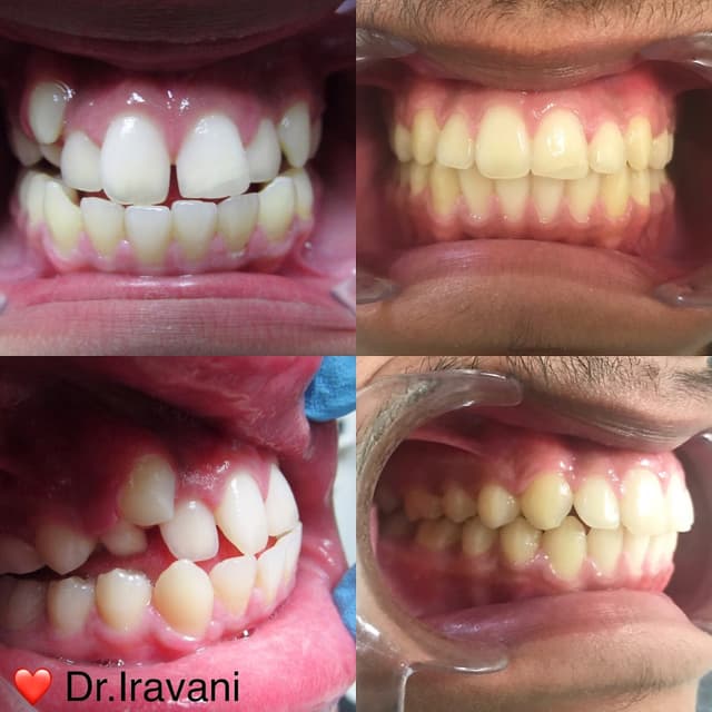 Gem Orthodontics photo