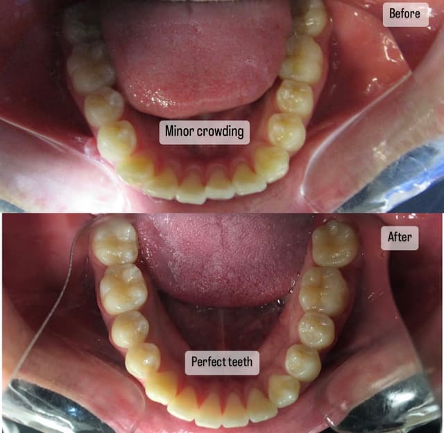 Gem Orthodontics photo