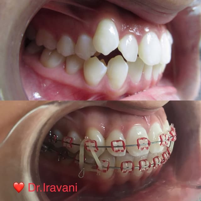 Gem Orthodontics photo