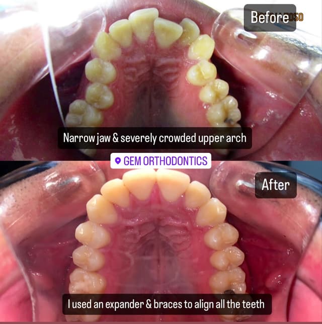 Gem Orthodontics photo