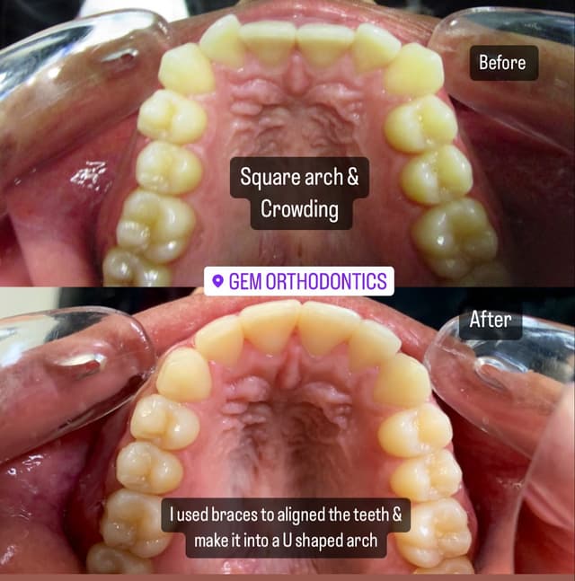 Gem Orthodontics photo