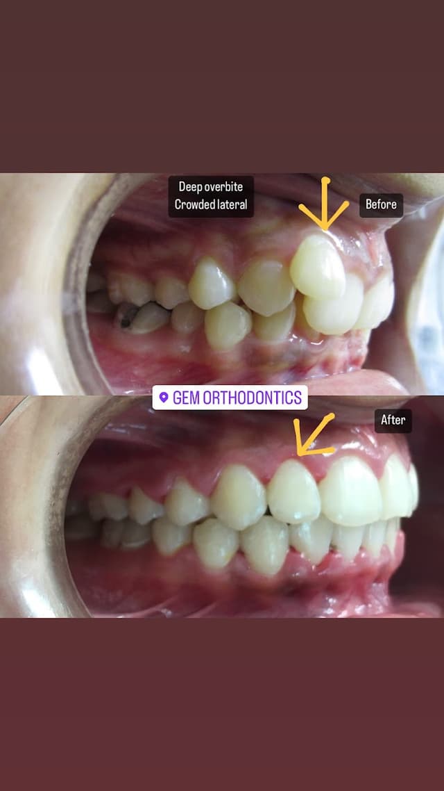 Gem Orthodontics photo