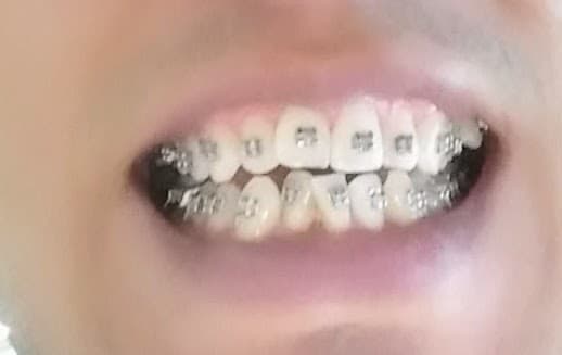 Ontario Kids 'N Braces photo