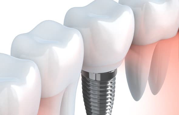 Anacapa Oral Surgery photo
