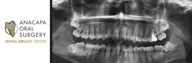 Anacapa Oral Surgery photo