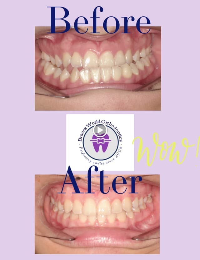 Braces World Orthodontics photo