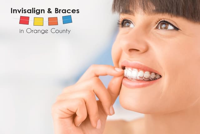 Invisalign and Braces in Orange County photo