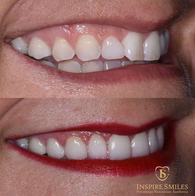 Inspire Smiles photo