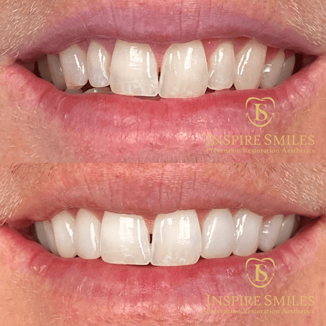 Inspire Smiles photo