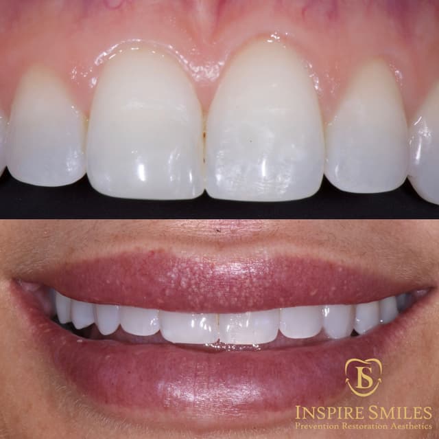 Inspire Smiles photo