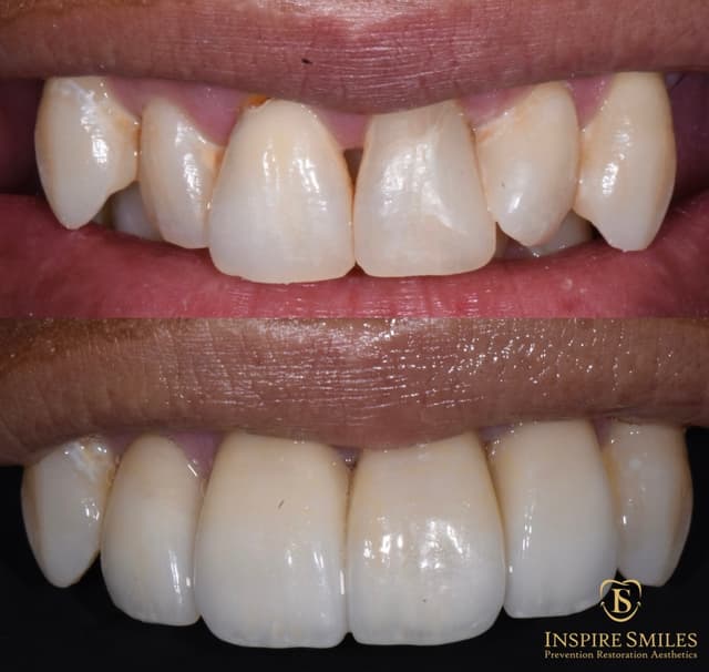 Inspire Smiles photo