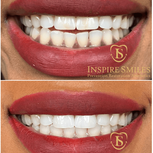 Inspire Smiles photo