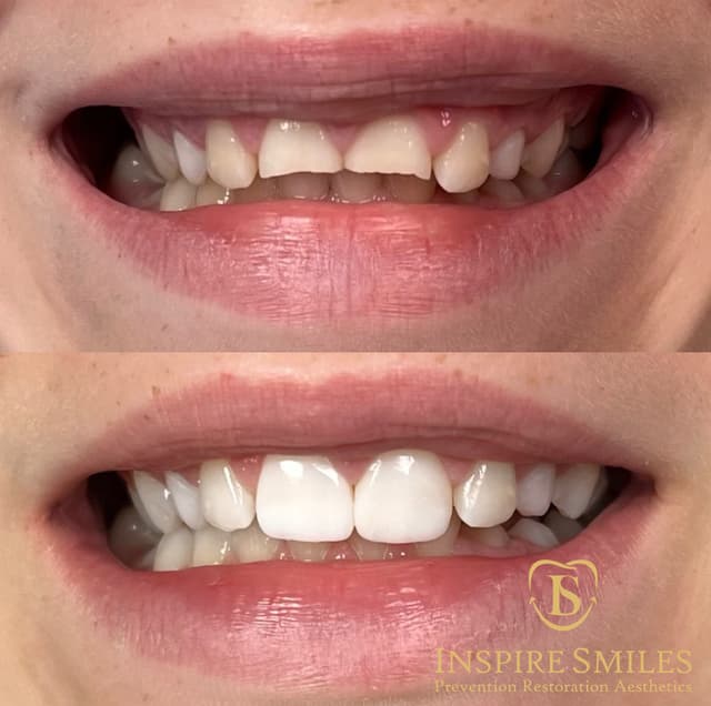 Inspire Smiles photo
