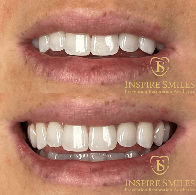 Inspire Smiles photo