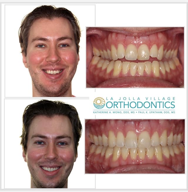 La Jolla Village Orthodontics photo