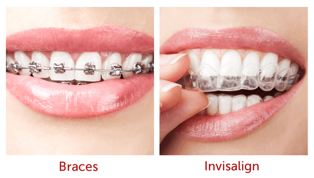 Align Orthodontics (Formerly Braces by Henry) photo