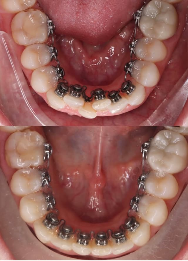 FitSmiles Orthodontics photo