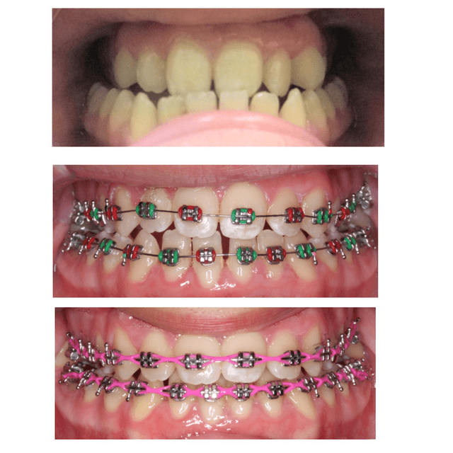 FitSmiles Orthodontics photo