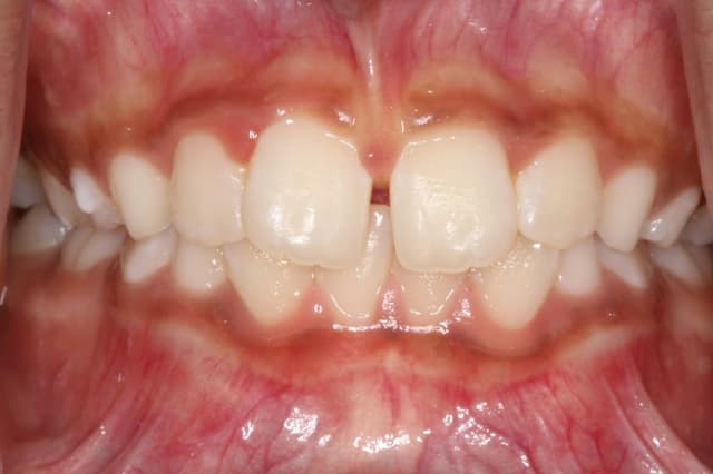 Palo Alto Orthodontics photo