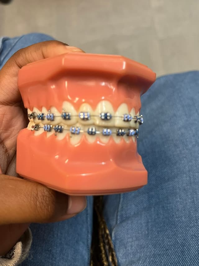 Co Op City Orthodontics photo