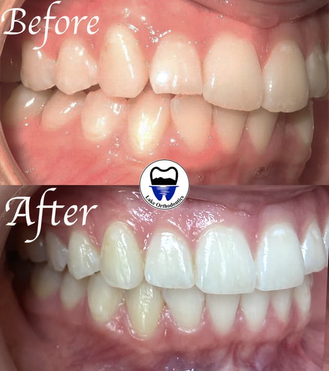 Lake Orthodontics photo