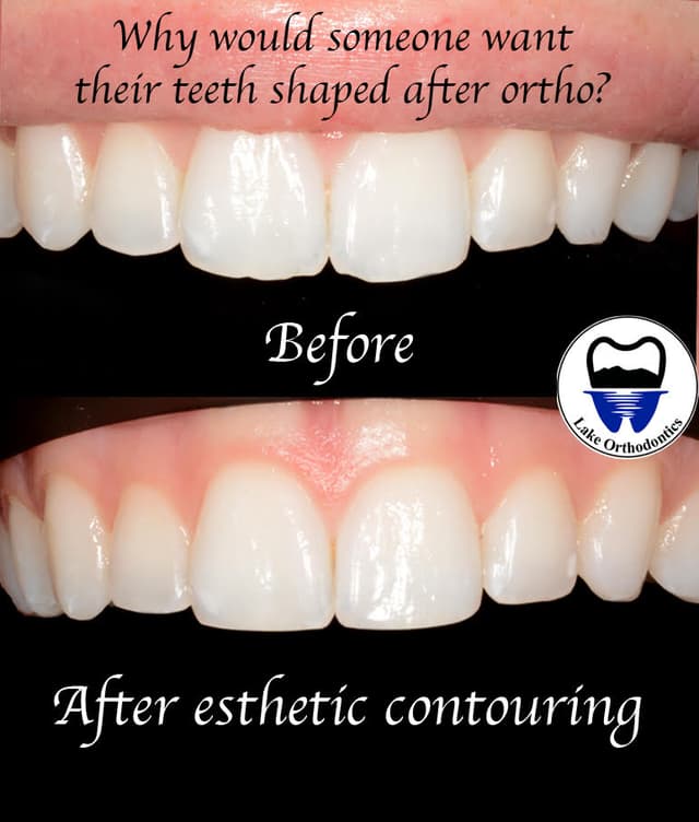 Lake Orthodontics photo
