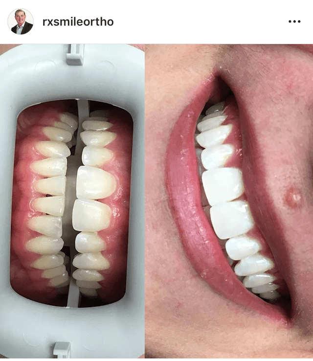 RxSmile Frisco Orthodontics photo