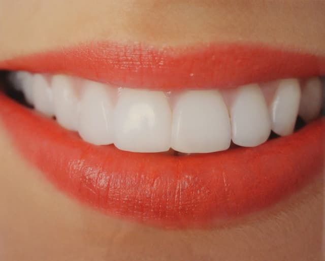 Clemente Orthodontics of New City photo