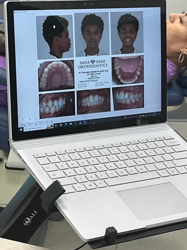 Smile Hero Orthodontics photo