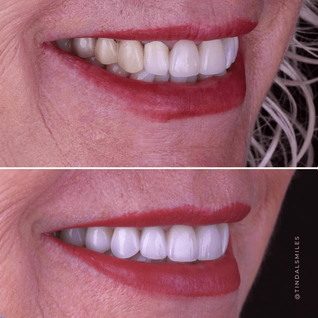 Tindal Prosthodontics photo