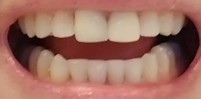 Montano Elevated Orthodontics photo