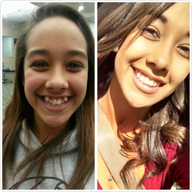 Montano Elevated Orthodontics photo