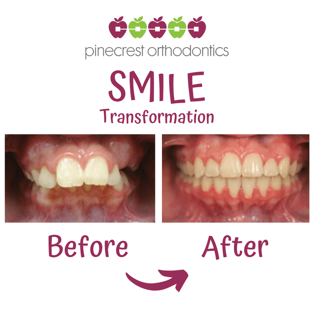 Pinecrest Orthodontics photo