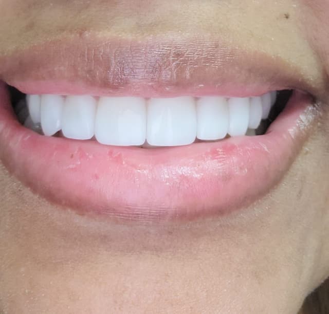 Marietta Smiles photo