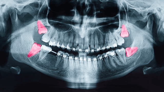 West Coast Oral Surgery photo