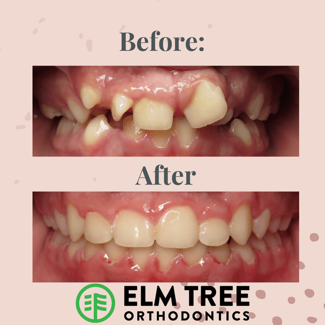 Elm Tree Orthodontics (formerly Brace-Asaurus Orthodontics) photo