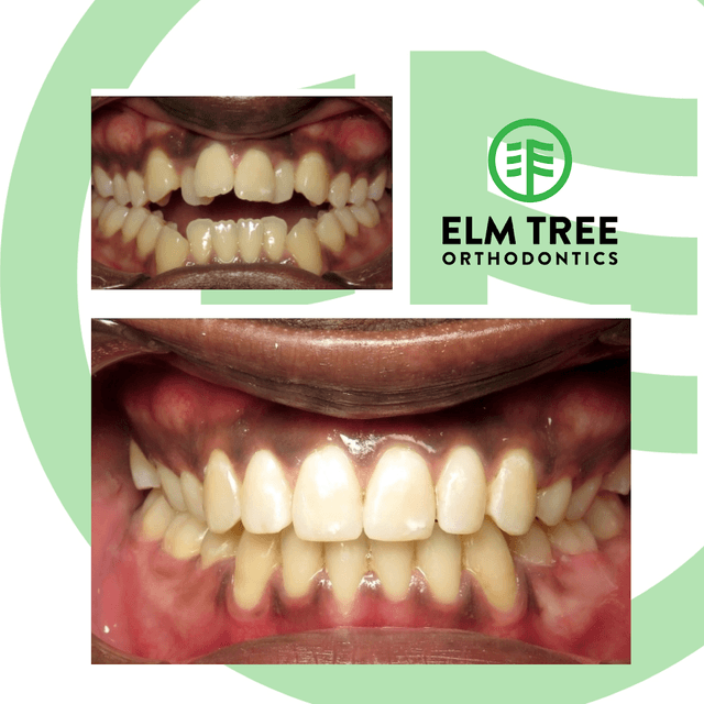 Elm Tree Orthodontics (formerly Brace-Asaurus Orthodontics) photo
