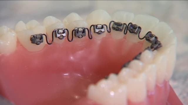 Yang Orthodontics - Invisalign & Braces in Langhorne photo
