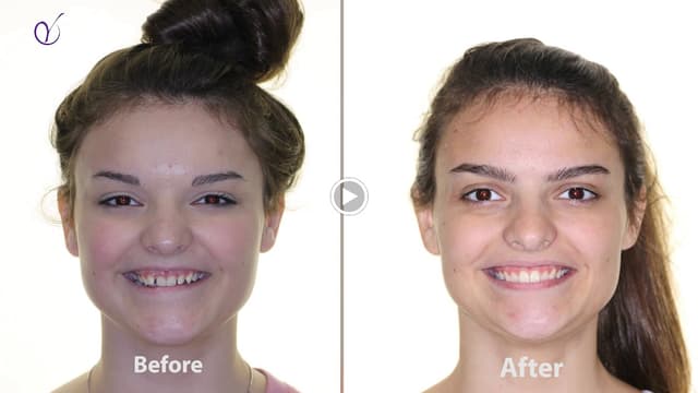 Yang Orthodontics - Invisalign & Braces in Langhorne photo