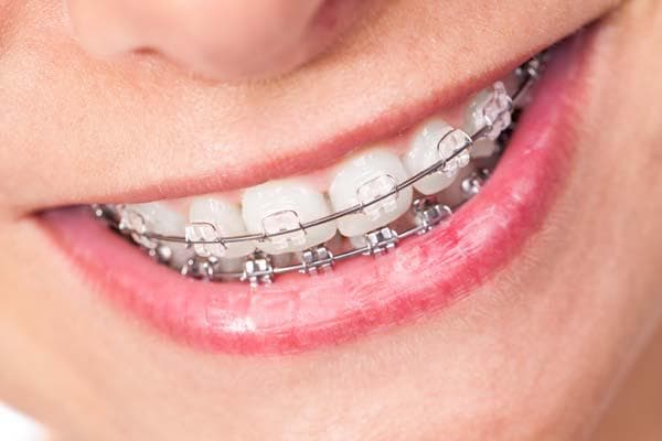 Yang Orthodontics - Invisalign & Braces in Langhorne photo