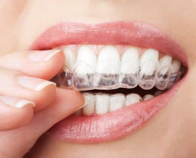 Yang Orthodontics - Invisalign & Braces in Langhorne photo